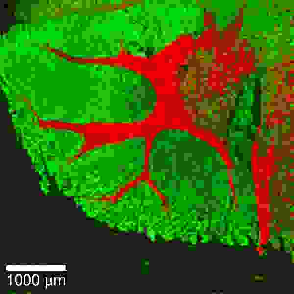 Confocal Raman image of a hamster brain tissue.