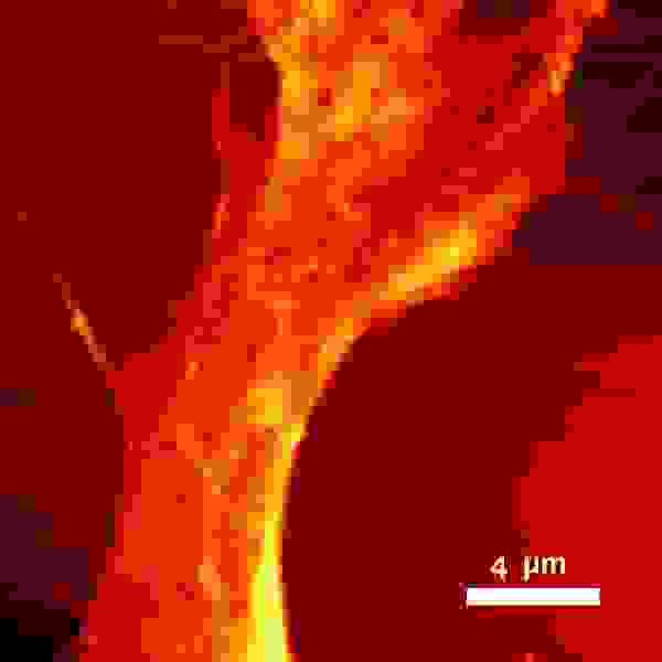 AFM image of a HeLa cell.