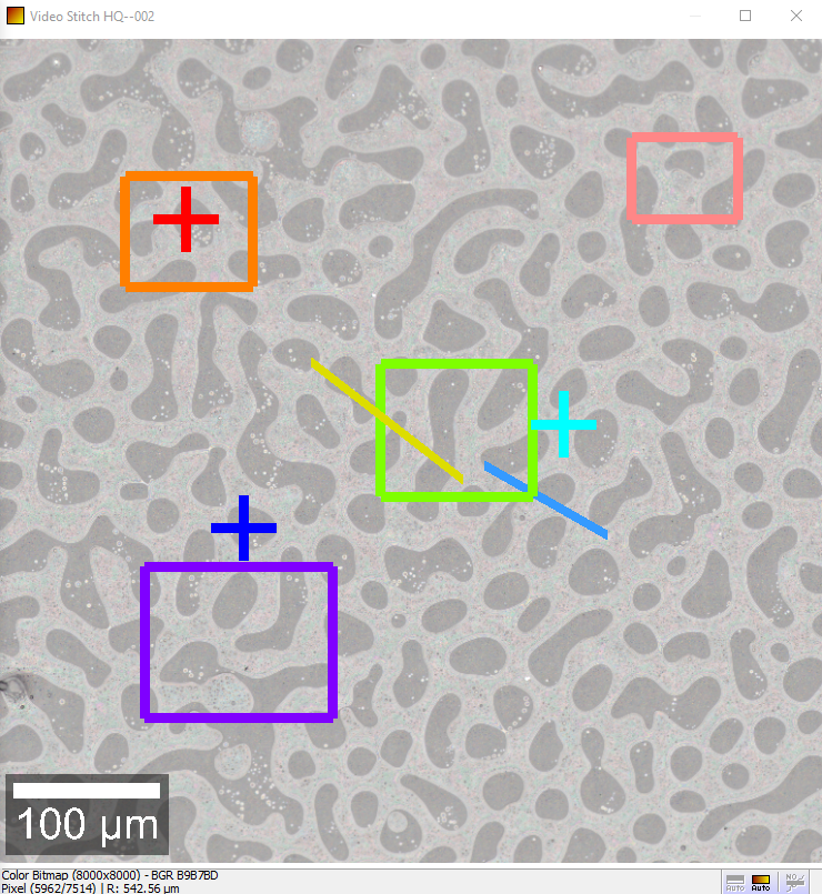 Intuitive selection of measurement areas and positions in the overview image